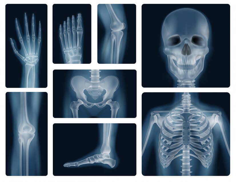 human-bones-realistic-x-ray-shots_1284-29690